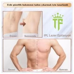 Trend Farma Soğuk Buz İpl Lazer Epilasyon Cihazı - 999.999 Atım,  Ağrısız buz lazer