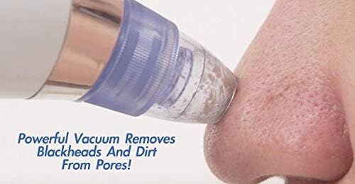 Derma Suction 40 Kpa Vakumlu Siyah Nokta ve Yüz Temizleme Cihazı